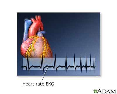 Biofeedback - Illustration Thumbnail
                      