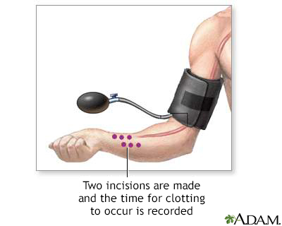 Blood clot test - Illustration Thumbnail
              