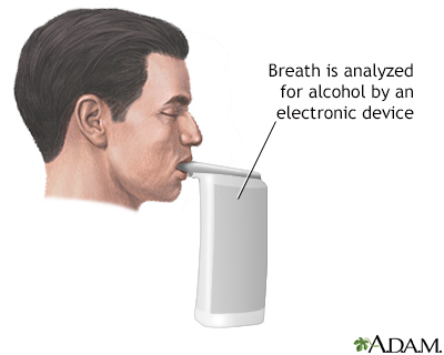 Breath alcohol test - Illustration Thumbnail
                      