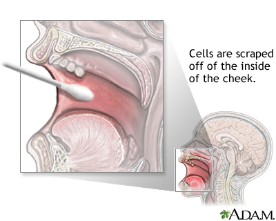 Buccal  smear - illustration - Illustration Thumbnail
              