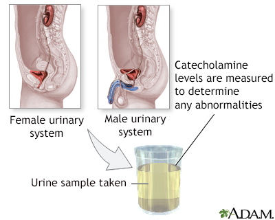 Catecholamine urine test - Illustration Thumbnail
              