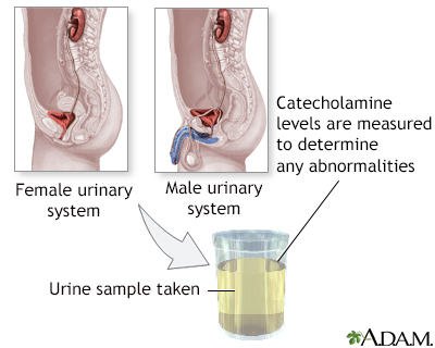 Catecholamine urine test - Illustration Thumbnail
                      