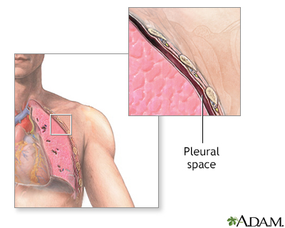 Pleural space - Illustration Thumbnail              