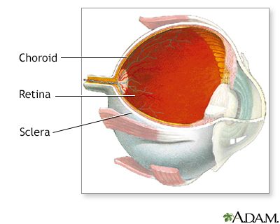 Choroid of the eye - Illustration Thumbnail
              