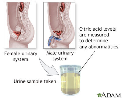 Citric acid urine test