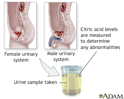 Citric acid urine test - Illustration Thumbnail
                      