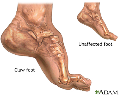 abnormal toe growth