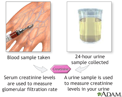 serum creatinine