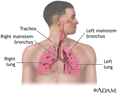 Lung Definition & Image