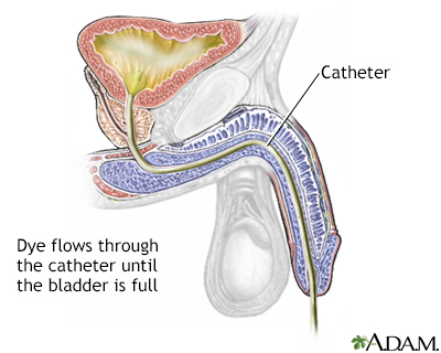 Cystography - Illustration Thumbnail
              