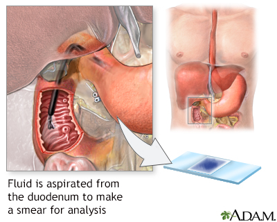 Duodenum tissue smear