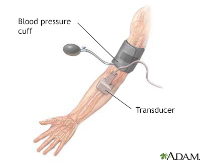 Duplex/doppler ultrasound test - Illustration Thumbnail
                      