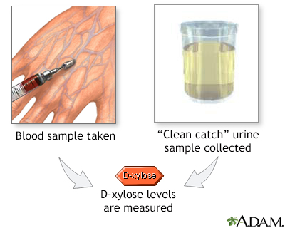 D-xylose level tests - Illustration Thumbnail
              