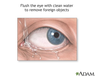 Foreign objects in eye