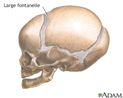 sunken anterior fontanelle