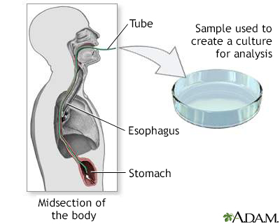 Culture of gastric tissue biopsy