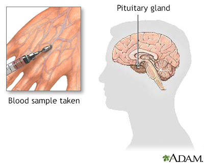 Growth hormone stimulation test Information Mount Sinai New York