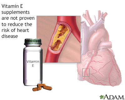 Vitamin E and heart disease - Illustration Thumbnail              