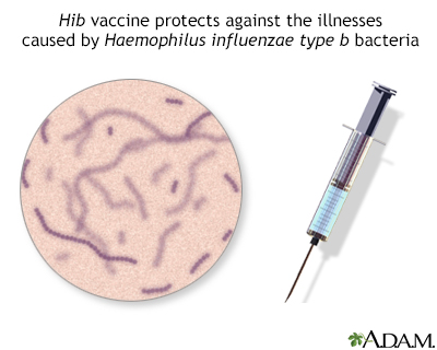 Hib immunization (vaccine) - Illustration Thumbnail
              