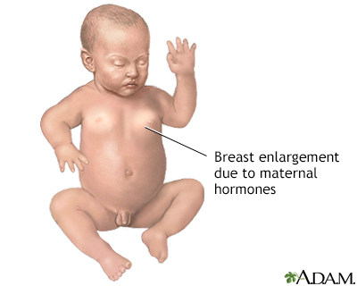 Hormonal effects in newborns - Illustration Thumbnail
              