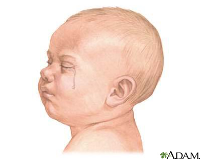 Excessive crying best sale in infants