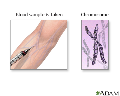 Karyotyping - Illustration Thumbnail
              