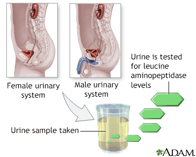 Leucine aminopeptidase urine test