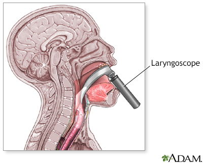 parts of laryngoscope