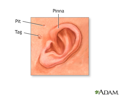 Newborn ear anatomy - Illustration Thumbnail              