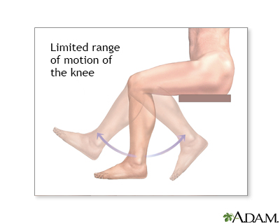 range of motion testing charts