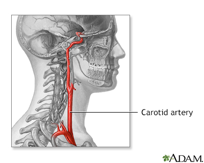 Carotid artery anatomy - Illustration Thumbnail              