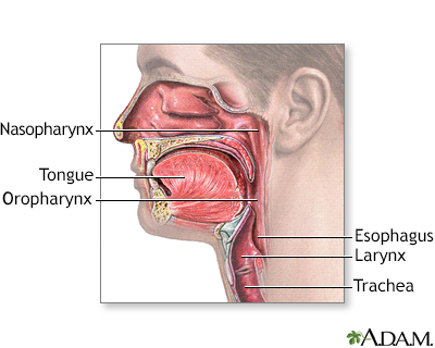 retropharyngeal abscess diagram