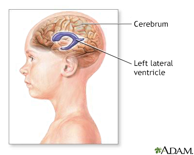 Ventricles of the brain - Illustration Thumbnail
              