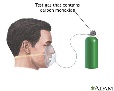 Lung diffusion testing - Illustration Thumbnail
              