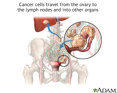 Malignancy - Illustration Thumbnail
              