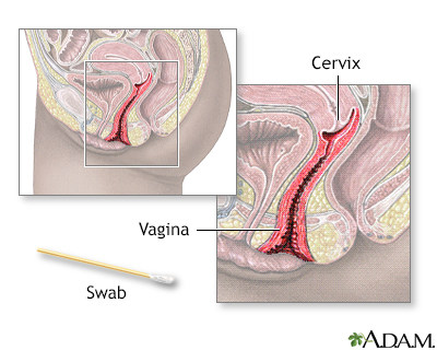 Pap smear - Illustration Thumbnail
              