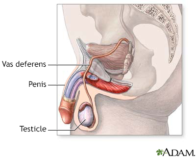 Disease Anorchia