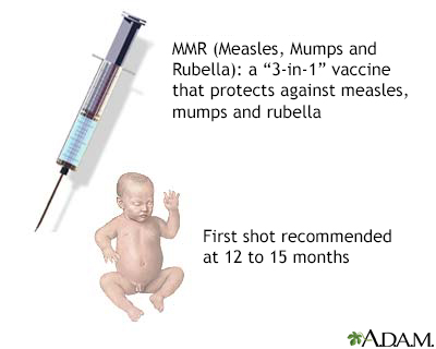 Vaccines (immunizations) overview Information Mount Sinai New York
