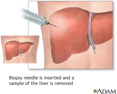 Liver culture - Illustration Thumbnail
              