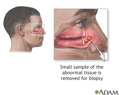 examination of nose anatomy