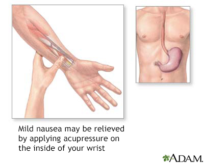 Nausea acupressure - Illustration Thumbnail
              