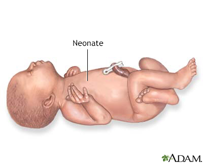 Neonate - Illustration Thumbnail
              