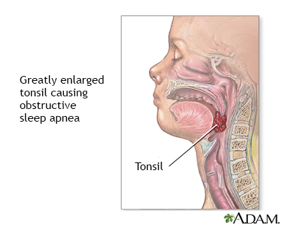 obstructive sleep apnea doctors near me