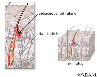 Hair follicle anatomy - Illustration Thumbnail
                      