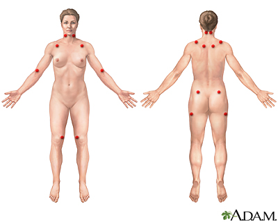 Body Pain - Breast Pain - Fibromyalgia - Joint & Muscle Pain