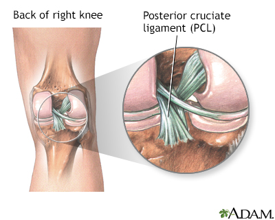 Ligamento cruciforme posterior de la rodilla