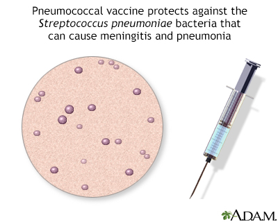 Pneumococcal vaccine - Illustration Thumbnail
              