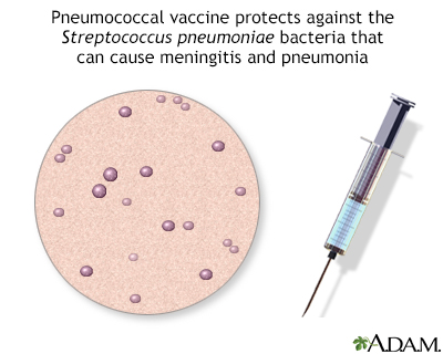 Pneumococcal vaccine - Illustration Thumbnail              