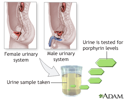 Porphyrin urine test