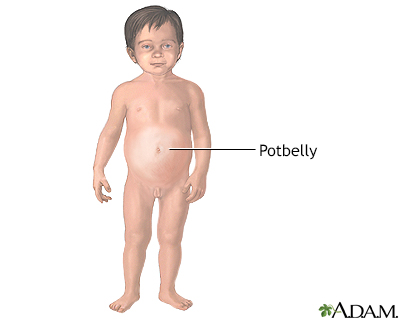 Baby potbelly sales